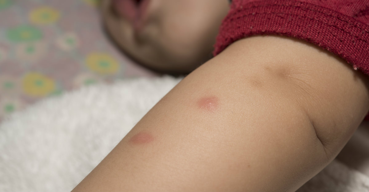 Quel Effet Zika A T Elle Sur Les Enfants Passport Health Quel Effet Zika A T Elle Sur Les Enfants Passport Health